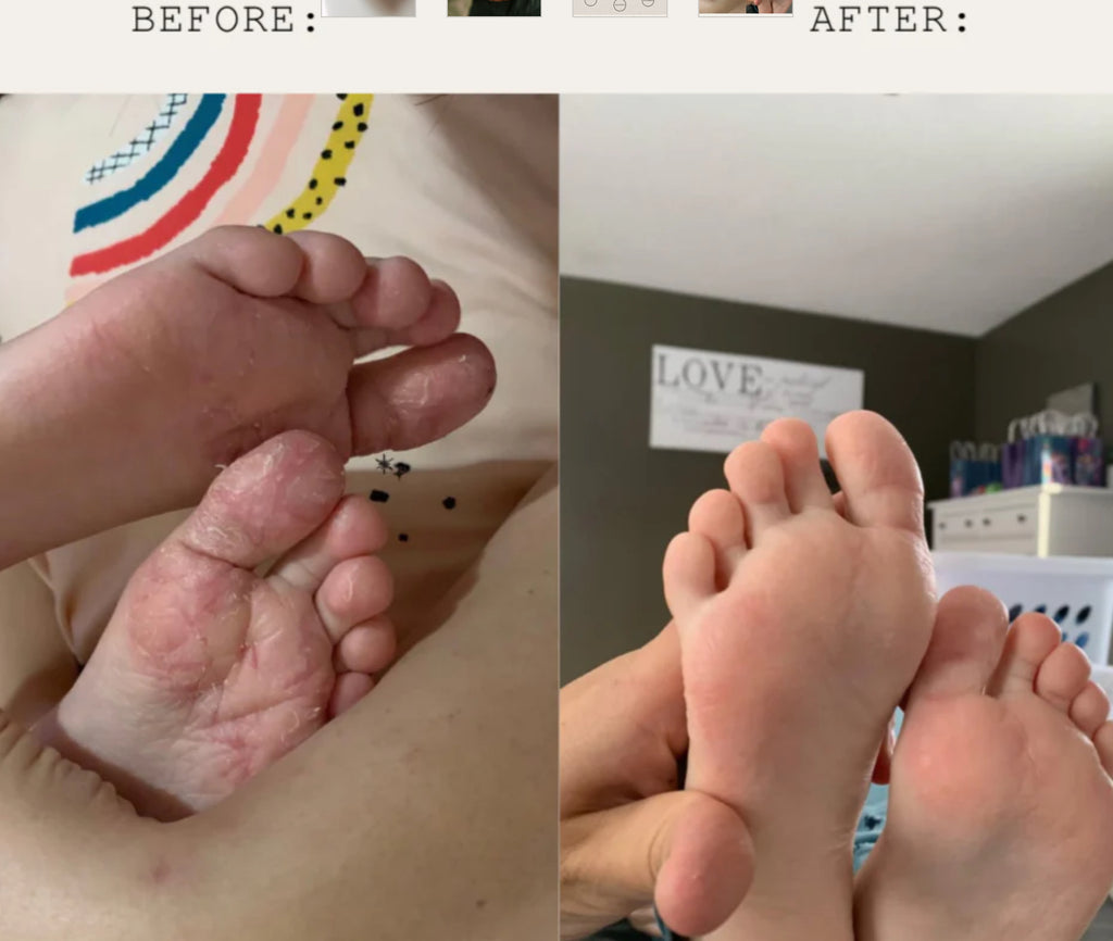 Luna Rosa Hippie Dippie Herbal Healing Balm