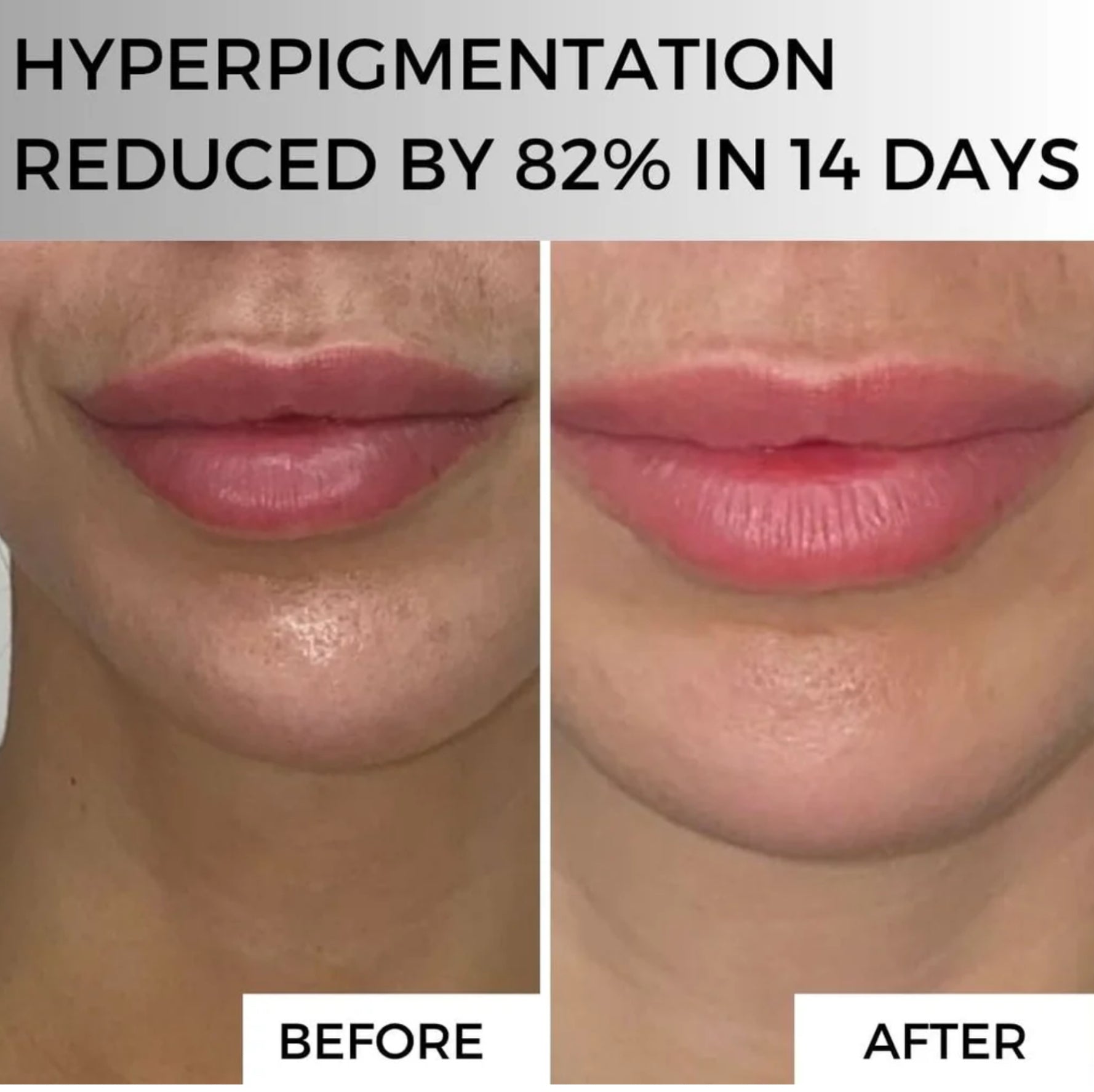 Mimar Ultra Vit C Concentrate image 2